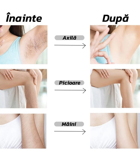 Epilator cu Cristale Neo™ Epyl®, Eliminarea Parului prin Frecare, Fara Durere, Unisex, Portabil, IP67, Black