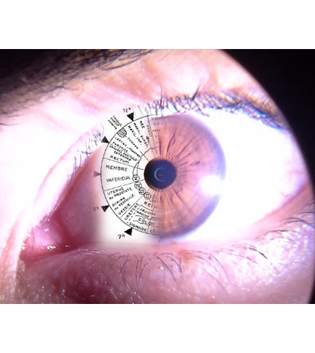 Iridologia - Consultație prin citirea irisului