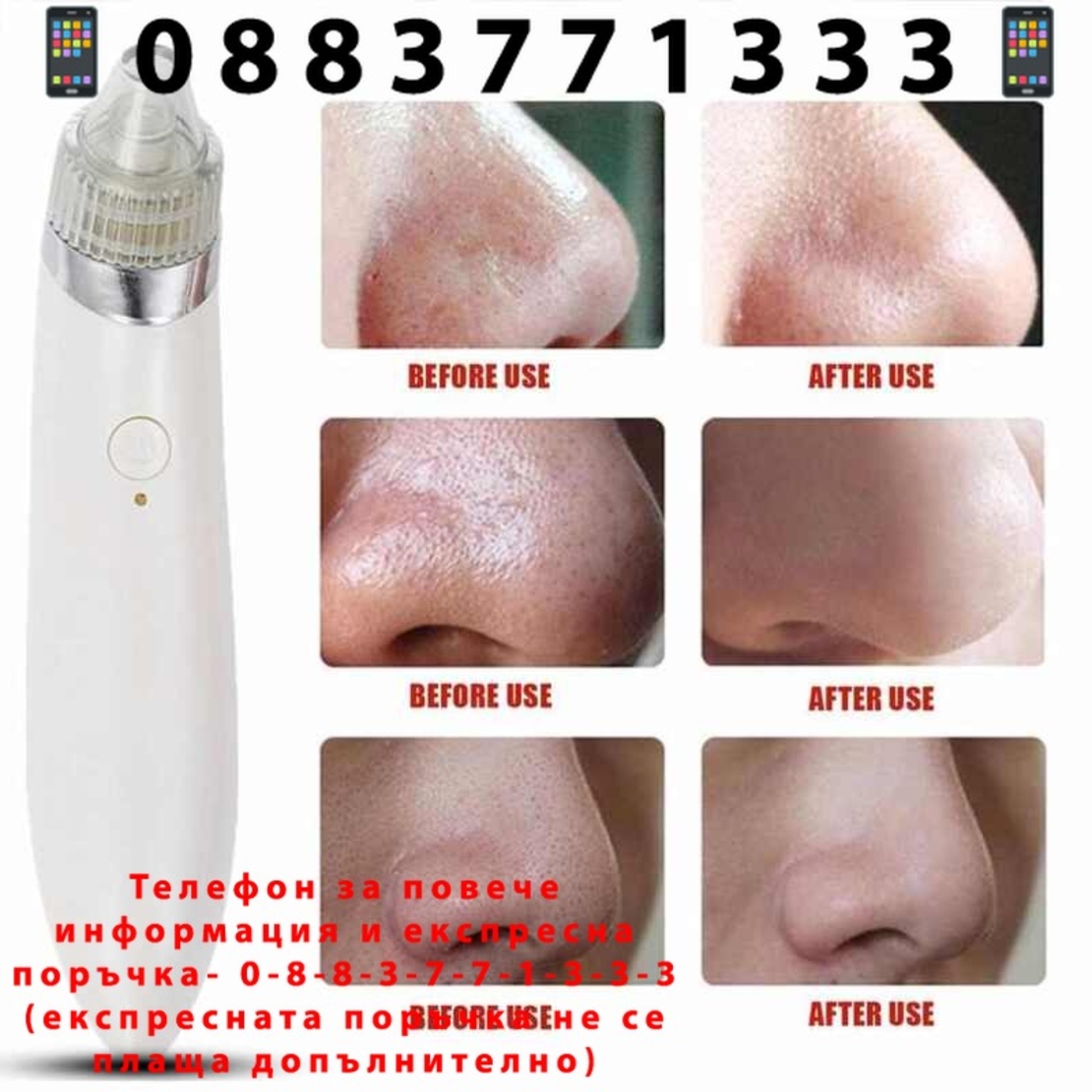 НЕМСКИ УРЕД ЗА ПОЧИСТВАНЕ НА ЛИЦЕ от черни точки XN 8030 + ЛЕД ФЕНЕР