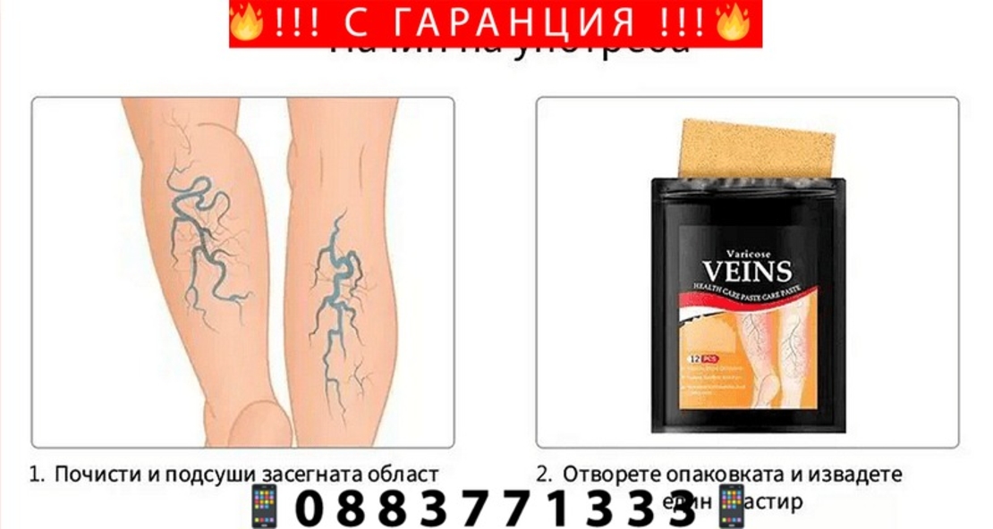 НЕМСКИ 24бр. Билкови Пластири за облекчаване на разширени вени + ЛЕД ФЕНЕР