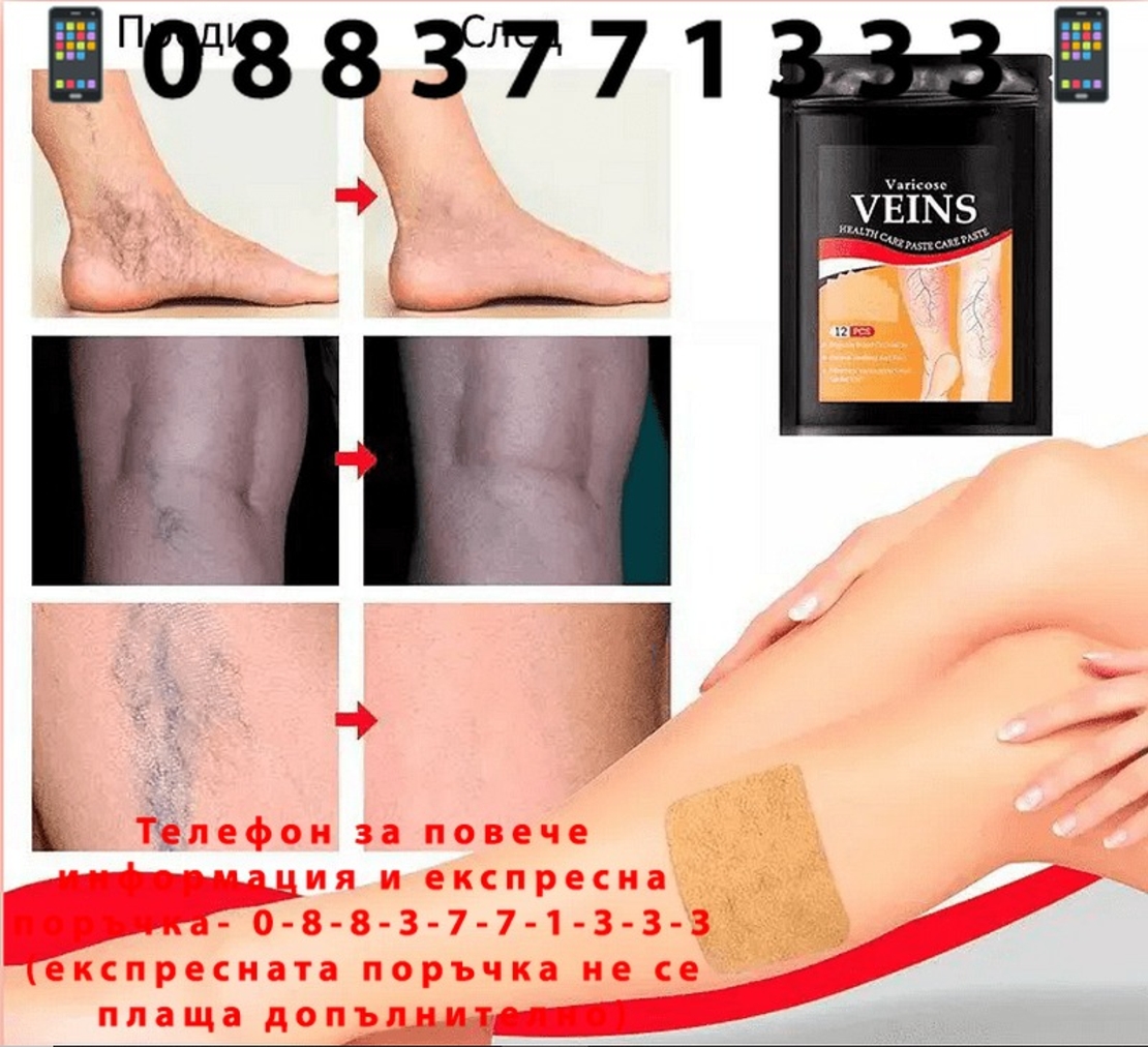 НЕМСКИ 24бр. Билкови Пластири за облекчаване на разширени вени + ЛЕД ФЕНЕР