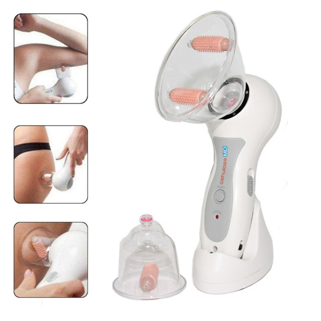 Антицелулитен масажор - Celluless MD - 283670