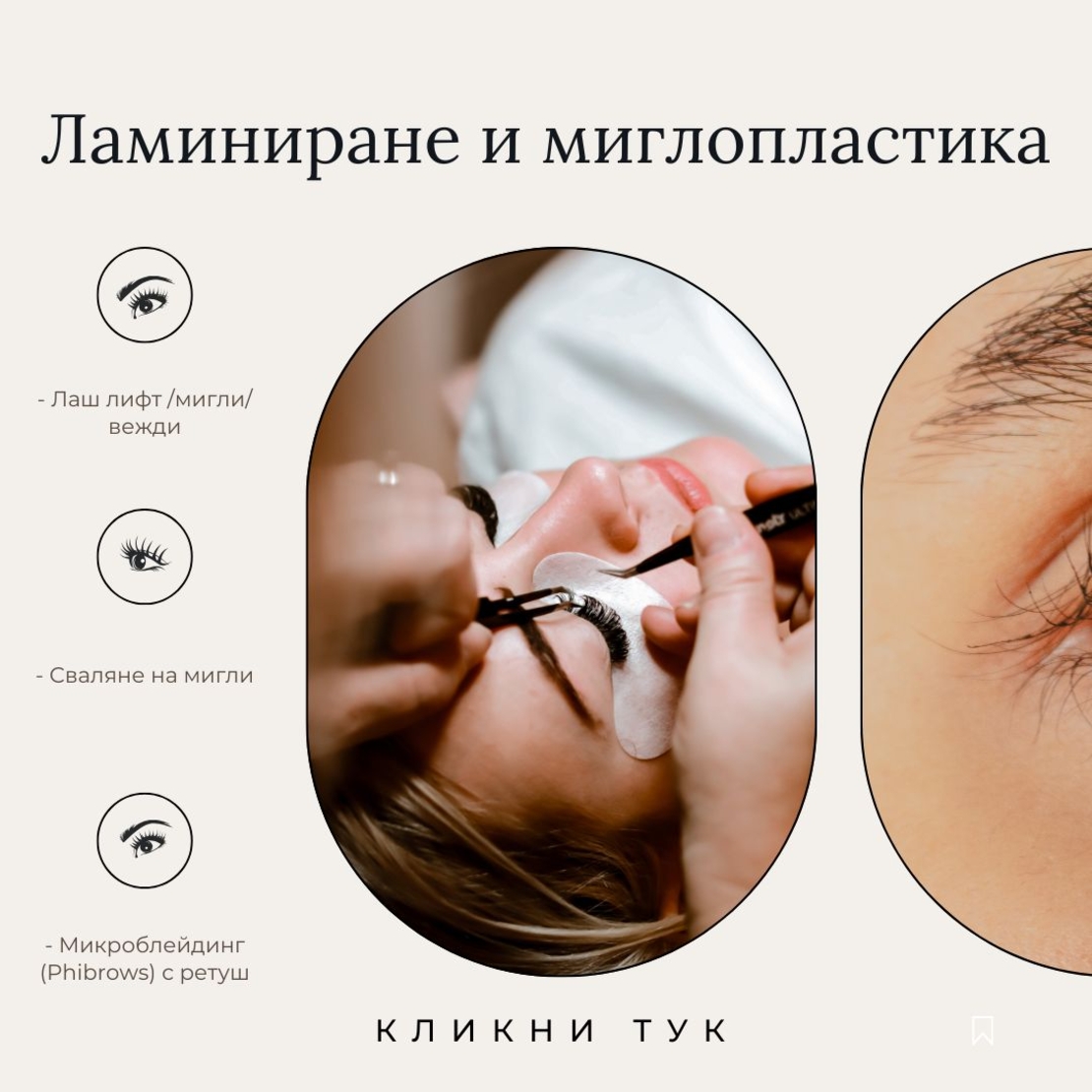 Миглопластика