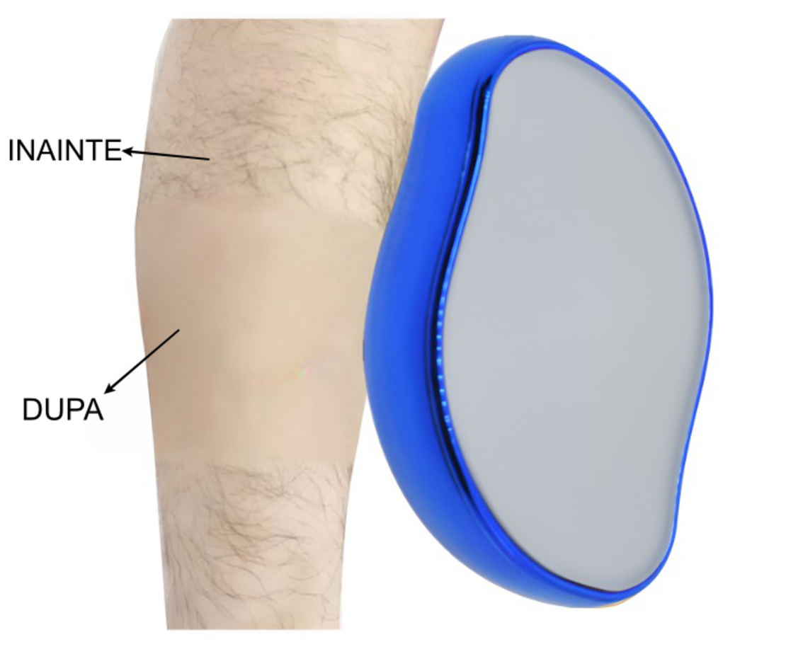 Epilator cu Cristale, pentru Epilarea de Lunga Durata, Albastru, Neo™