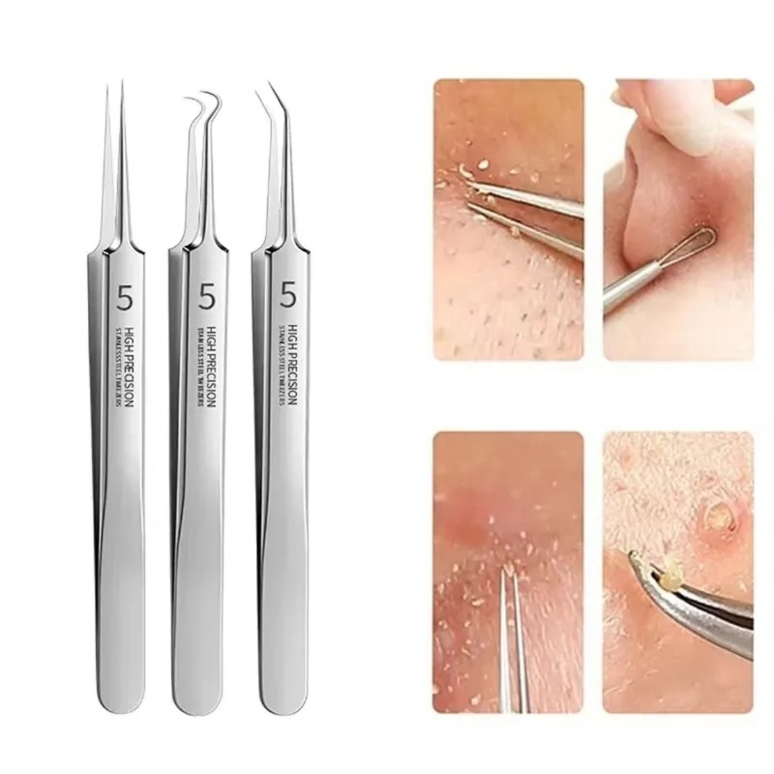 Set 6 pensete pentru extractie puncte negre, comedoane, acnee, ustensile cosmetice din inox, metalic, Neo™ Premium®