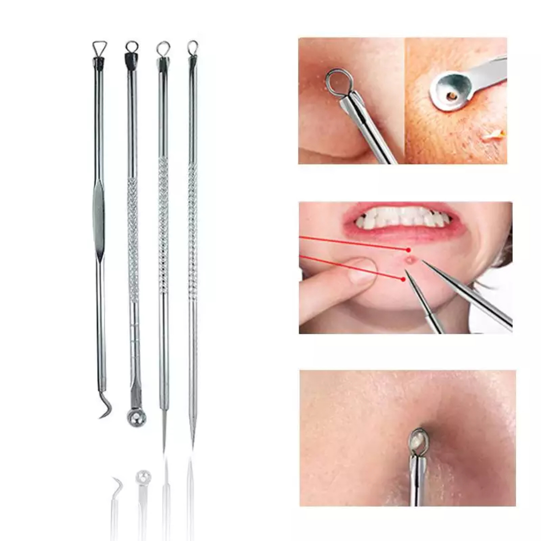 Set 4 Pensete pentru Extractie Puncte Negre, Cosuri, Acnee, Comedoane, Neo™ Premium, din inox, metalice