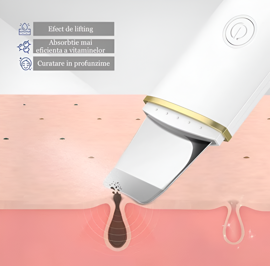 Aparat de curatare faciala cu ultrasunete NEO™, lifting ten, skin scrubber, indepartare puncte negre, hidratare, peeling, Alb
