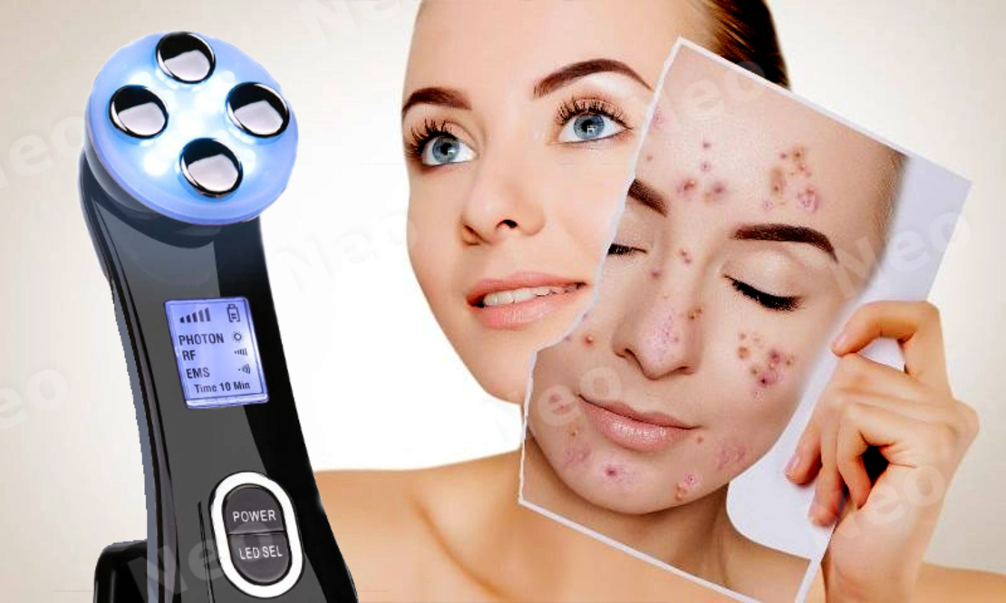 Aparat Profesional de ingrijire faciala prin Rejuvenare cu Fotoni 5 in 1 Neo Photon™, pentru intinerirea pielii, efect anti-rid, tratament Electroporare, RF lumina LED, inchide porii, elimina acneea, albire, pentru fata/gat, stativ incarcare rapida, Negru