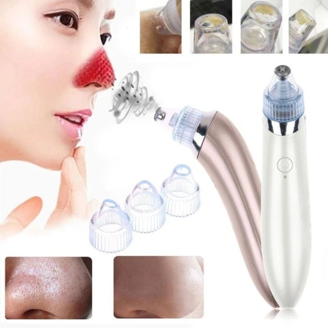 Aparat Neo™ Vaccum Cleaner, pentru indepartare puncte negre, acnee, sebum, functie de curatare, 4 capete de schimb, incarcare USB