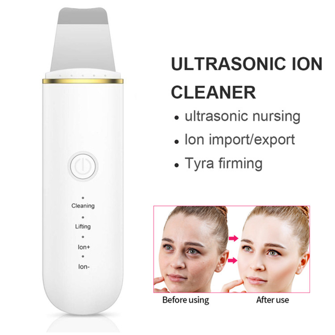 Aparat de curatare faciala cu ultrasunete, Neo™ Skin®, lifting ten, skin scrubber, spatula indepartare puncte negre, hidratare, peeling, Alb