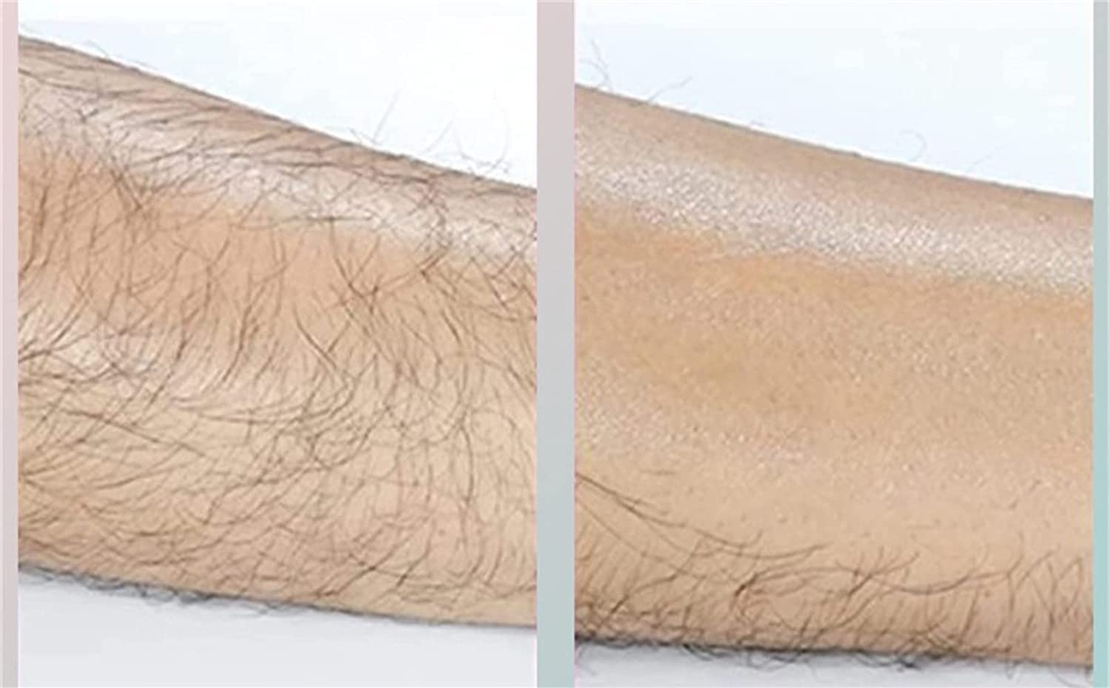 Dispozitiv de Epilare prin Frecare cu cristale, Salestore.ro® pentru indepartarea parului si exfoliere, reutilizabil, fara durere, Roz Cald