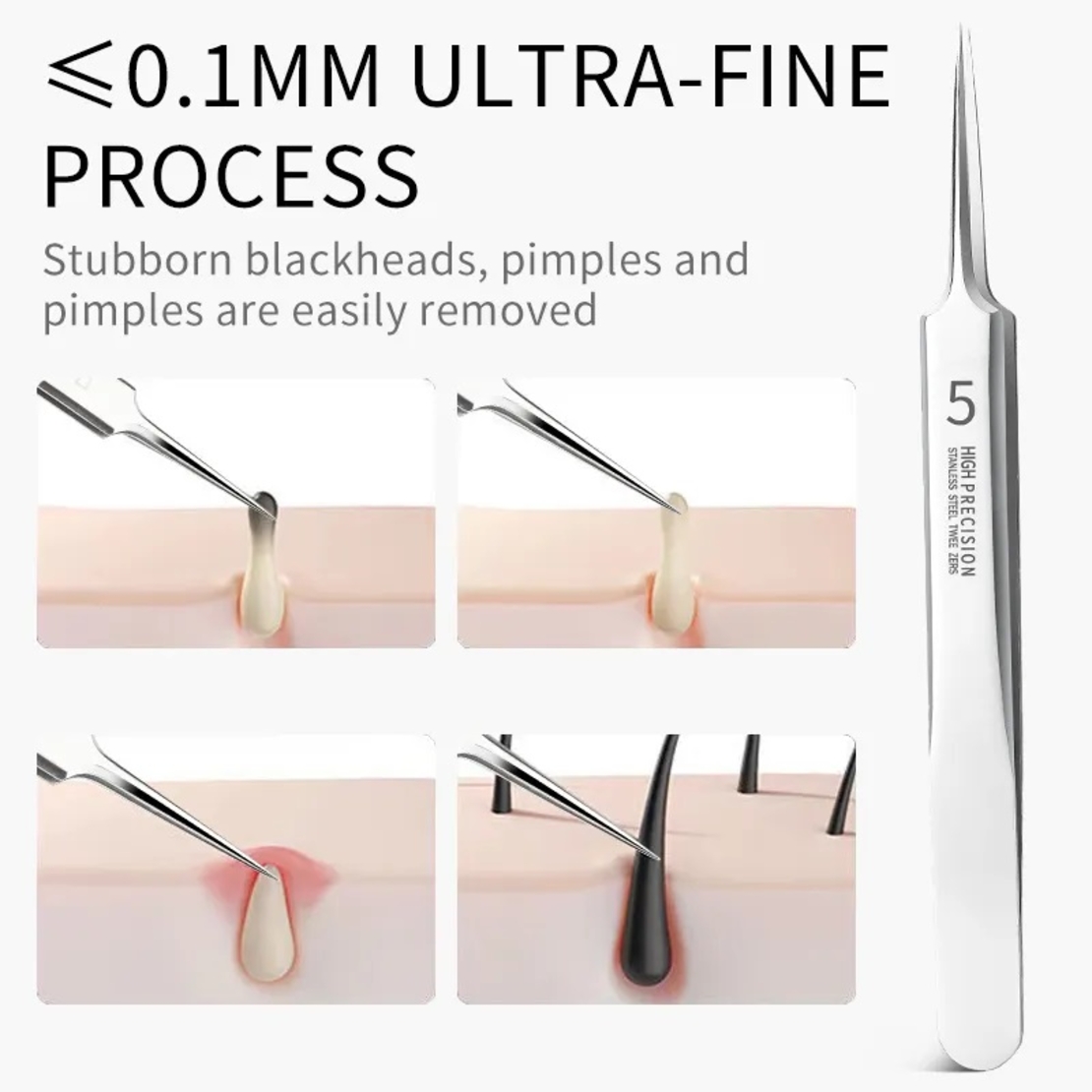 Set 6 pensete pentru extractie puncte negre, comedoane, acnee, ustensile cosmetice din inox, metalic, Neo™ Premium®