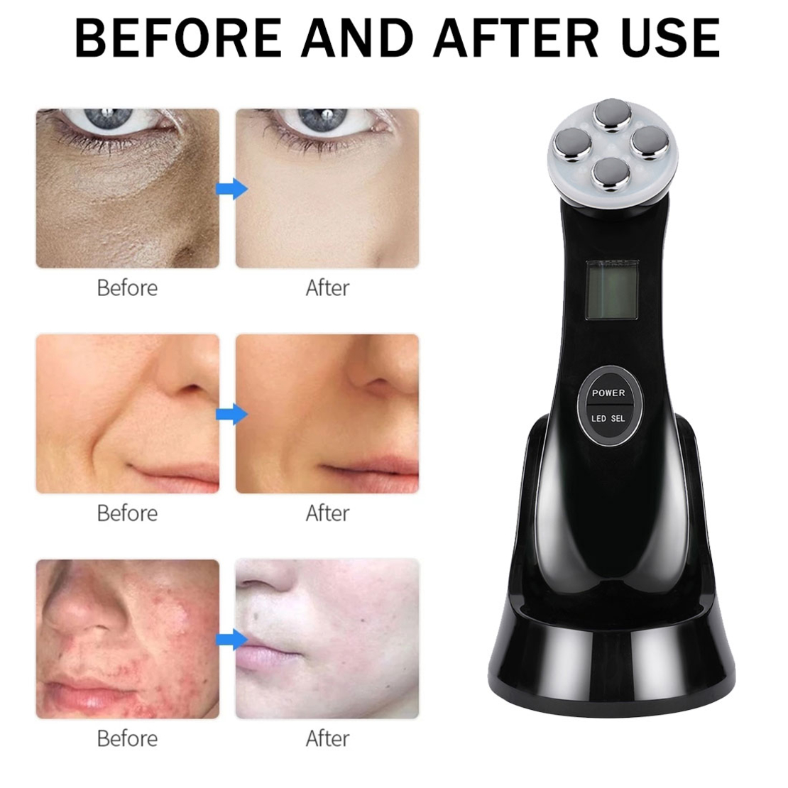 Aparat Profesional de ingrijire faciala prin Rejuvenare cu Fotoni 5 in 1 Neo Photon™, pentru intinerirea pielii, efect anti-rid, tratament Electroporare, RF lumina LED, inchide porii, elimina acneea, albire, pentru fata/gat, stativ incarcare rapida, Negru