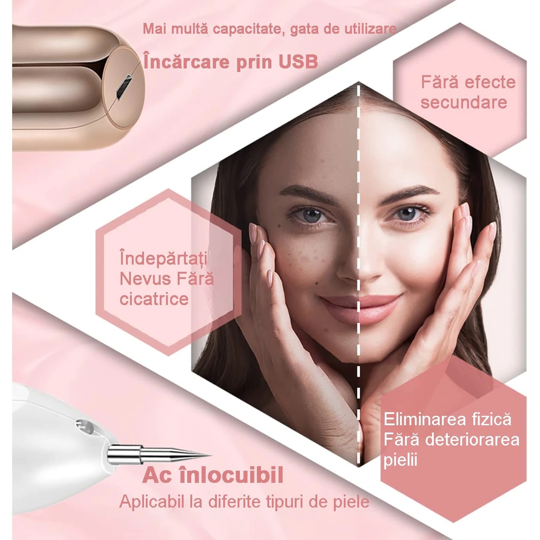 Aparat Plasma Pen, Neo™ cu 5 ace de schimb incluse, 9 viteze, pentru indepartare negi, pete, tatuaje, alunite, cicatrici, pistrui, Lifting pleoape, PlasmaPen®, Ecran LCD, Auriu/Alb