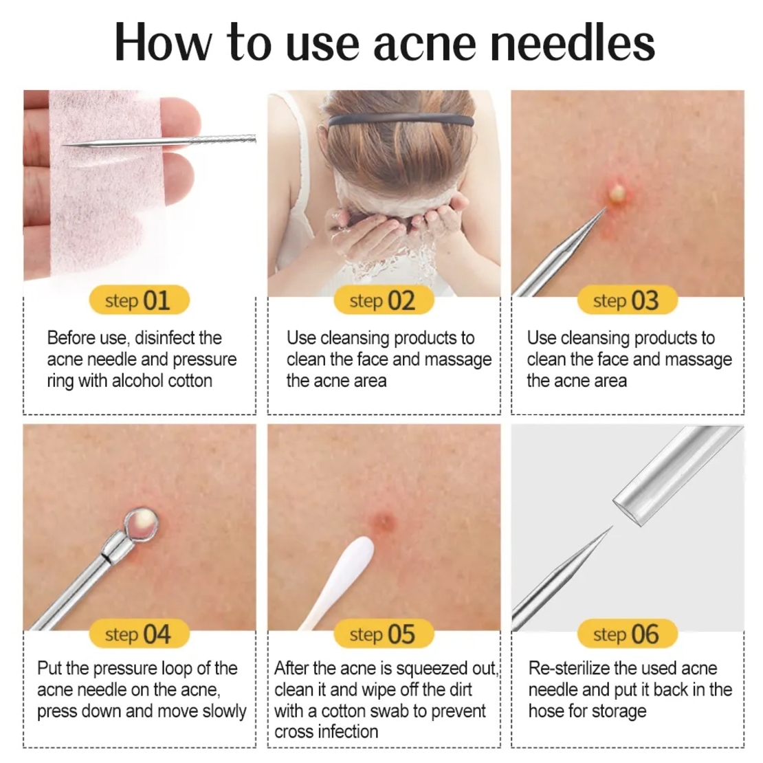Set 7 pensete pentru extractie puncte negre, comedoane, acnee, ustensile cosmetice din inox, metalic, Neo™ Premium®