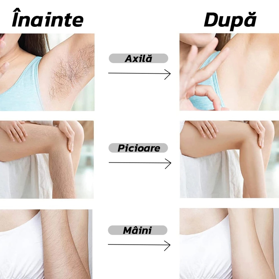 Dispozitiv de Epilare Neo™ Epyl® prin Frecare, Reutilizabil, Portabil, tip Cristal, Fara Durere, Argintiu
