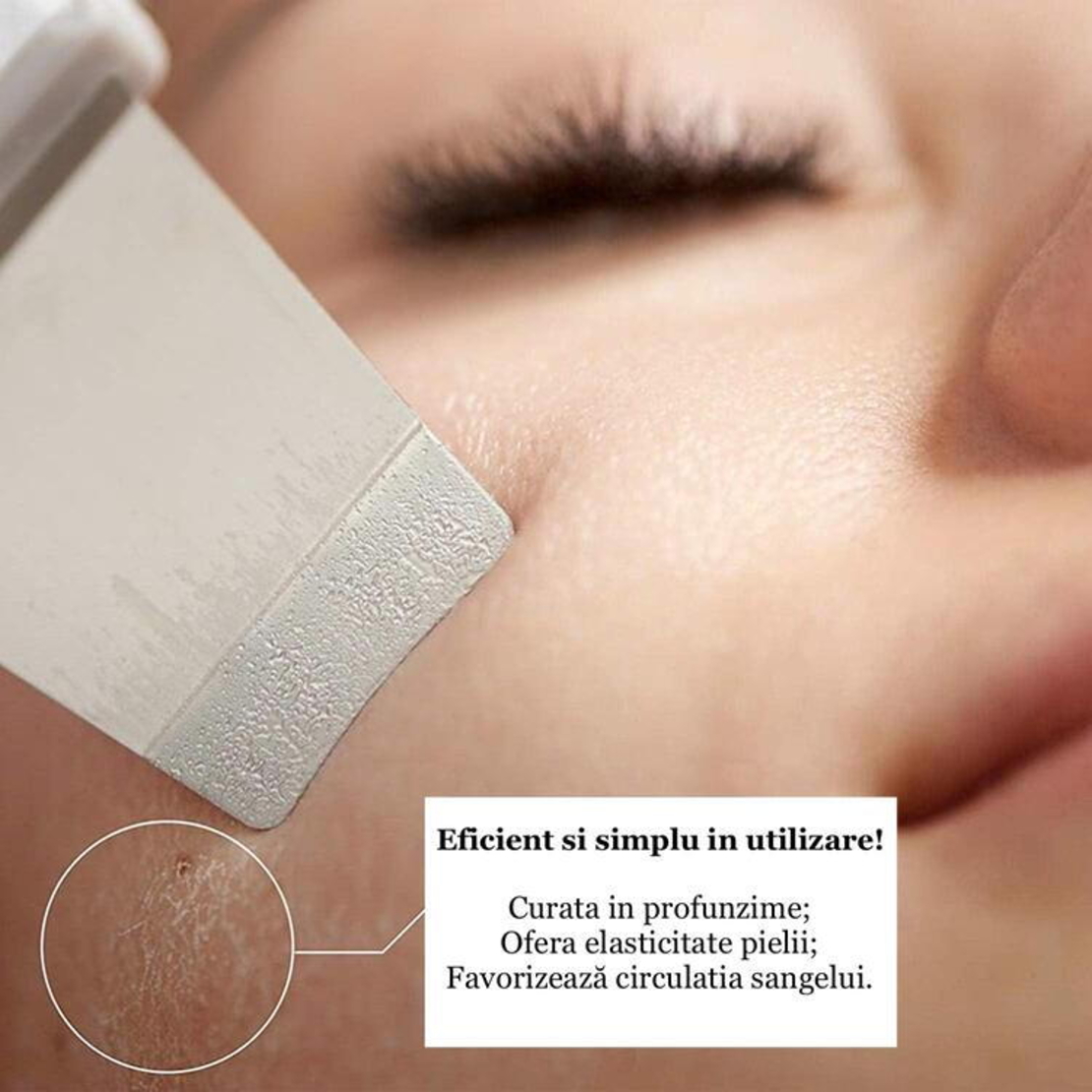 Aparat de curatare faciala cu ultrasunete, indepartare puncte negre, hidratare, curatare ten, anti rid, anti imbatranire, acumulator, alb