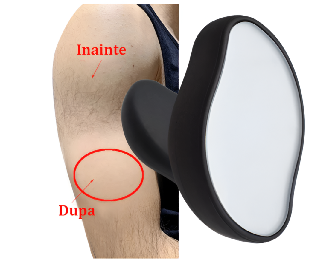 Epilator cu Cristale, pentru Epilarea de Lunga Durata, Negru, Neo™
