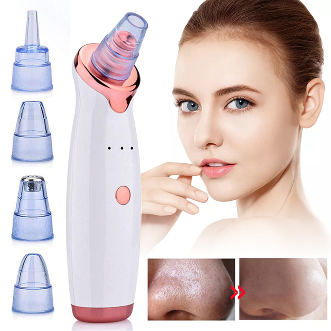 Aparat indepartat puncte negre, Neo™ Premium, cu vacuum, 5 capete, Puteri ajustabile, Ingrijire faciala, Curatare faciala, Acnee, Incarcare USB, Alb