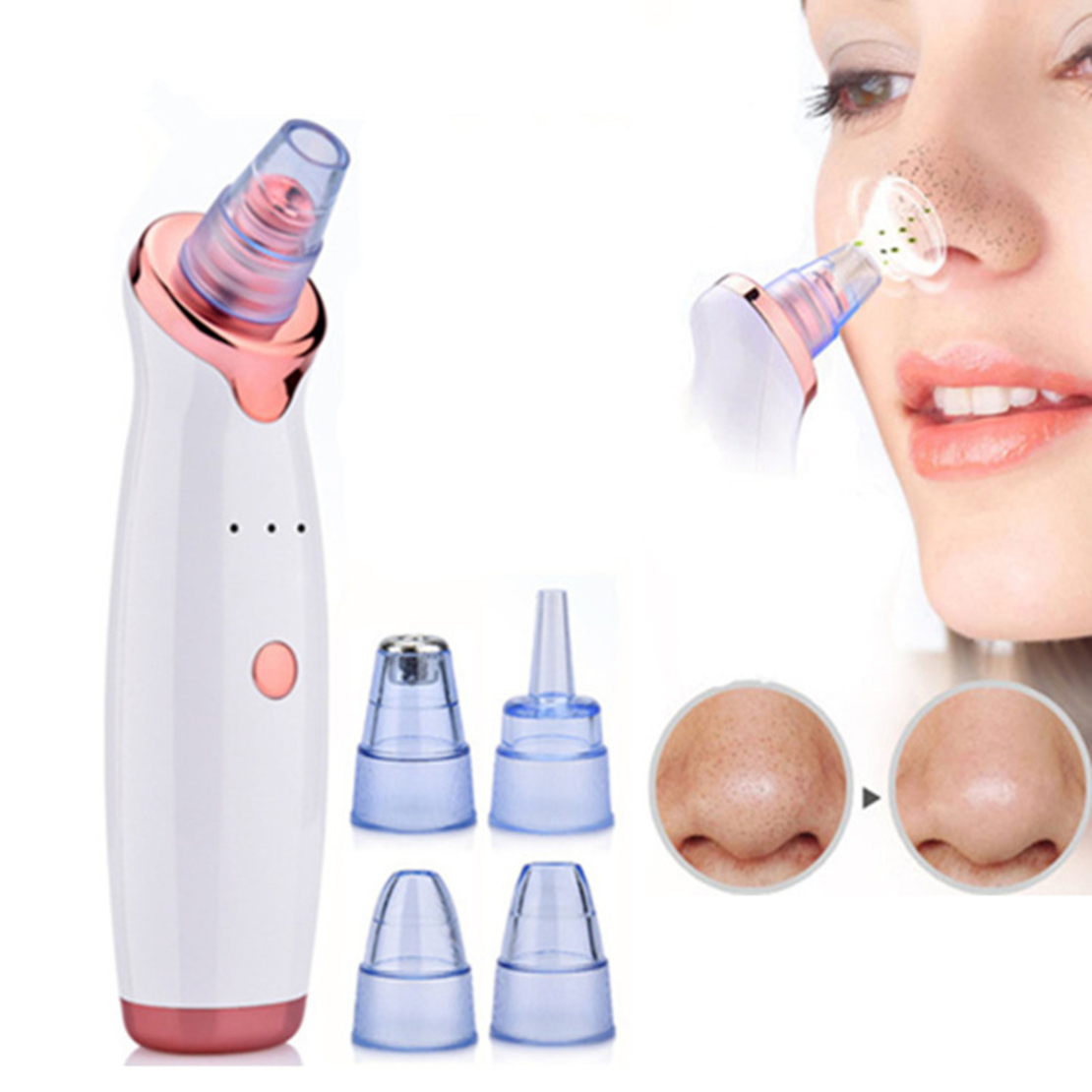 Aparat indepartat puncte negre, Neo™ Premium, cu vacuum, 5 capete, Puteri ajustabile, Ingrijire faciala, Curatare faciala, Acnee, Incarcare USB, Alb