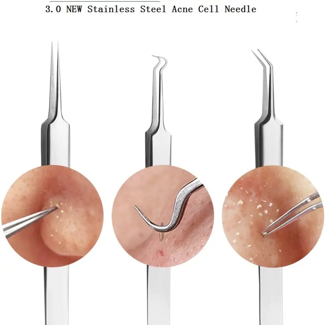 Set 5 pensete pentru extractie puncte negre, ustensile cosmetice din inox, metalic, acnee, comedoane, Neo™ Premium®