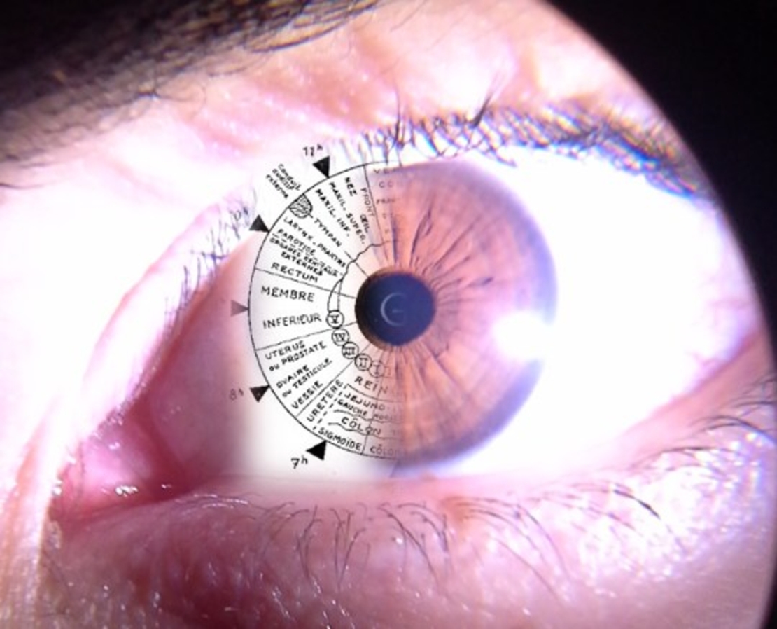 Iridologia - Consultație prin citirea irisului