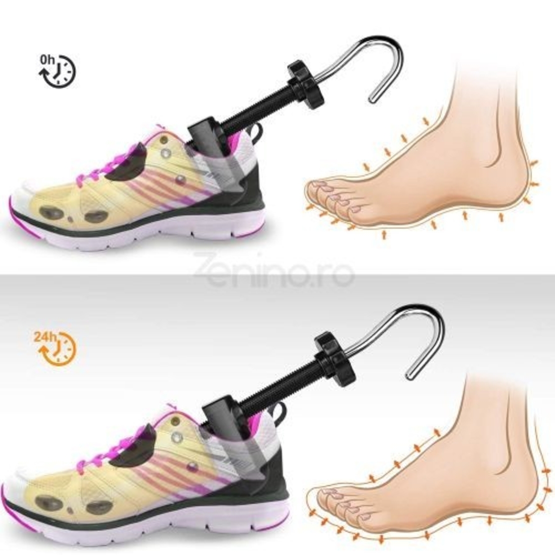 Set 2 Sanuri/Calapoade Reglabilile, Flippy, pentru Alungit si Largit Pantofi, Geanta si Incaltator Incluse, Universale, Unisex, din ABS Premium, Arc, Marime 30 - 36, Galben