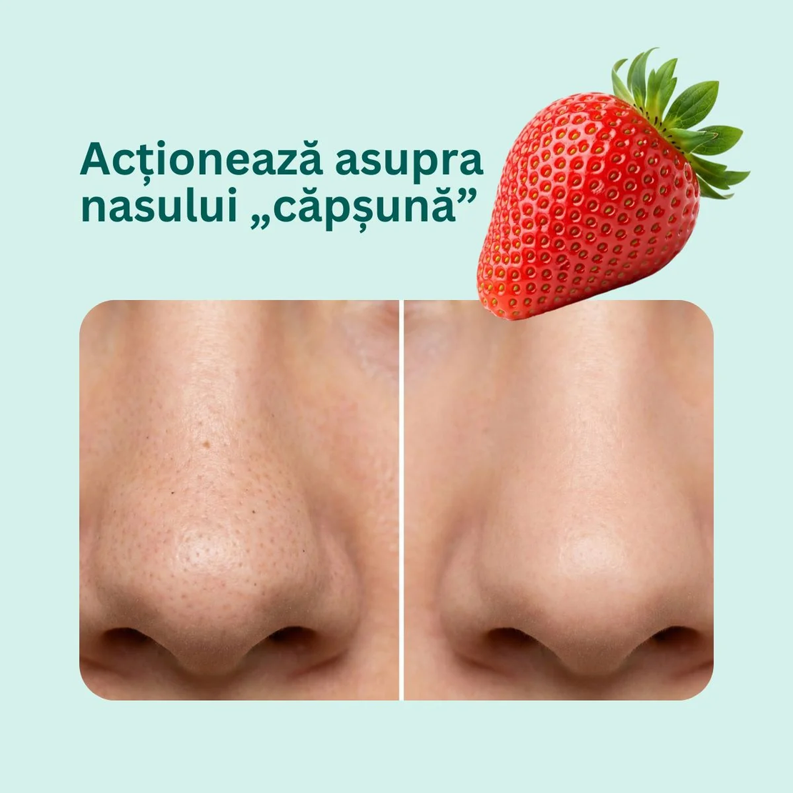 Momirov-Exfoliant facial MicroDerm, 50 ml