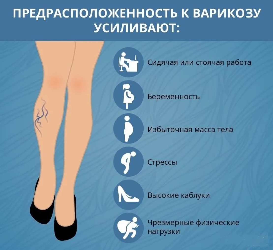 Фитокомплекс 'Легкость в ногах'