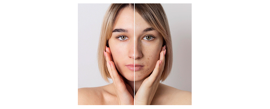 Estetică și Îngrijirea Pielii